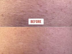 First Aid Beauty Promo Your Skins New Best Friend