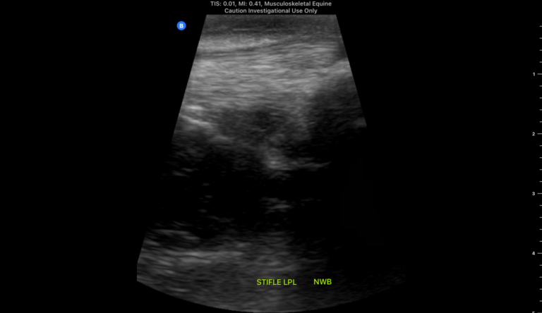 Ultrasound probe probes kut Ultrasound probe probes kut