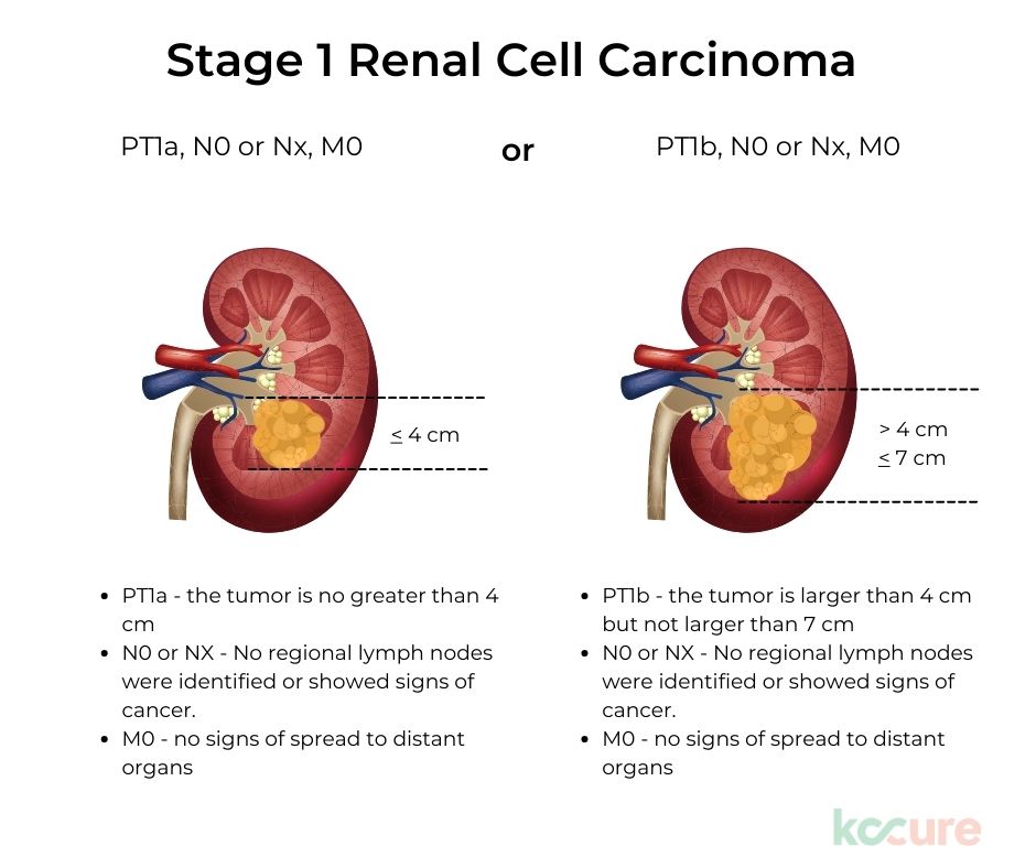 Cancers | Free Full-Text | First-Line Treatment of Metastatic Clear ...